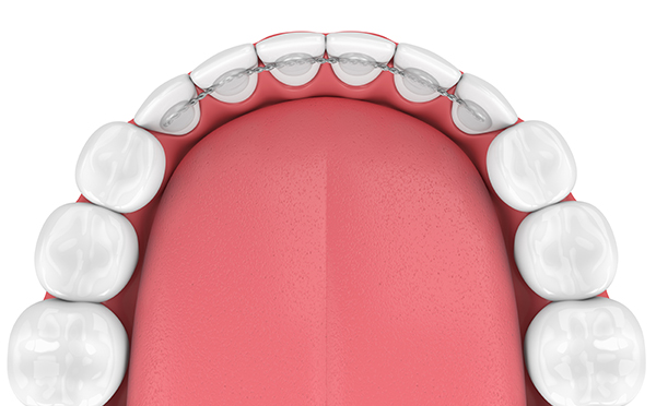 Orthodontiste Orange